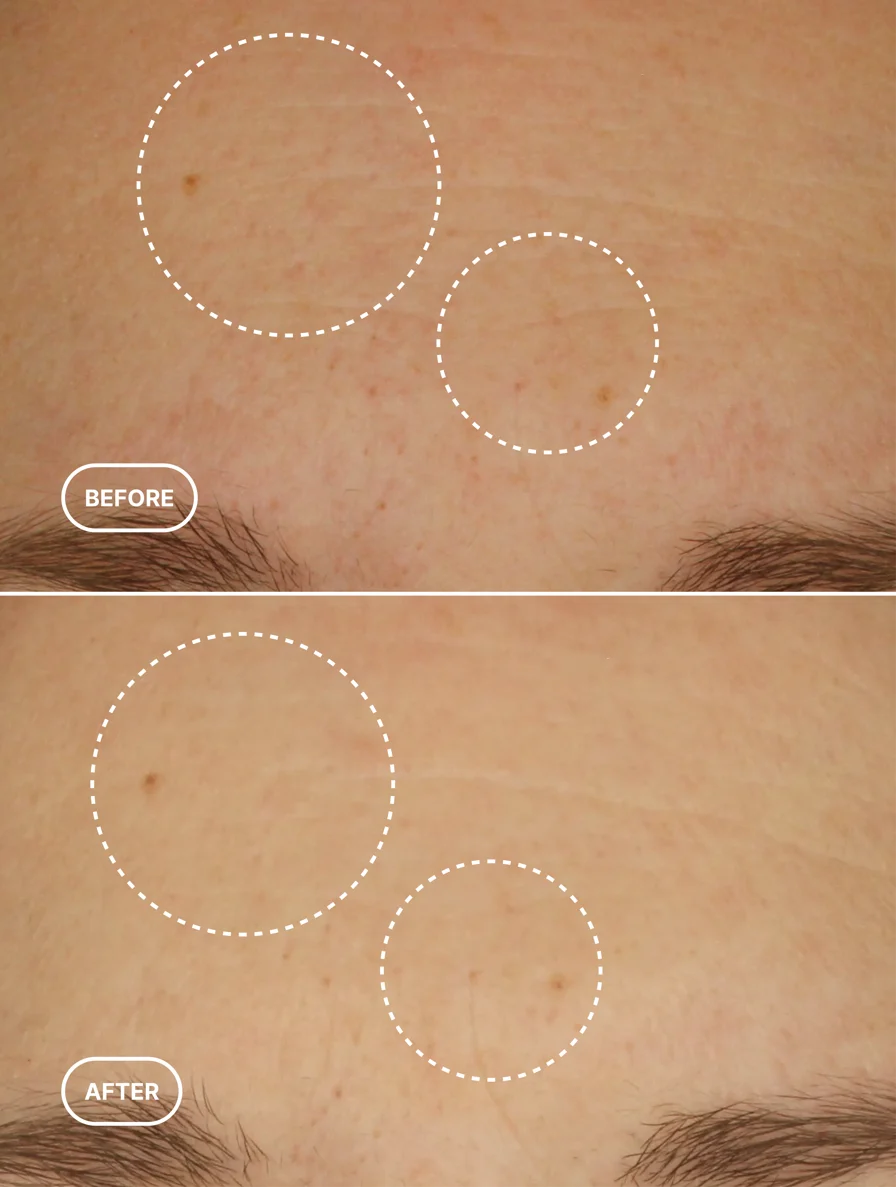Bio-Retinol Serum