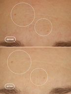 Bio-Retinol Serum