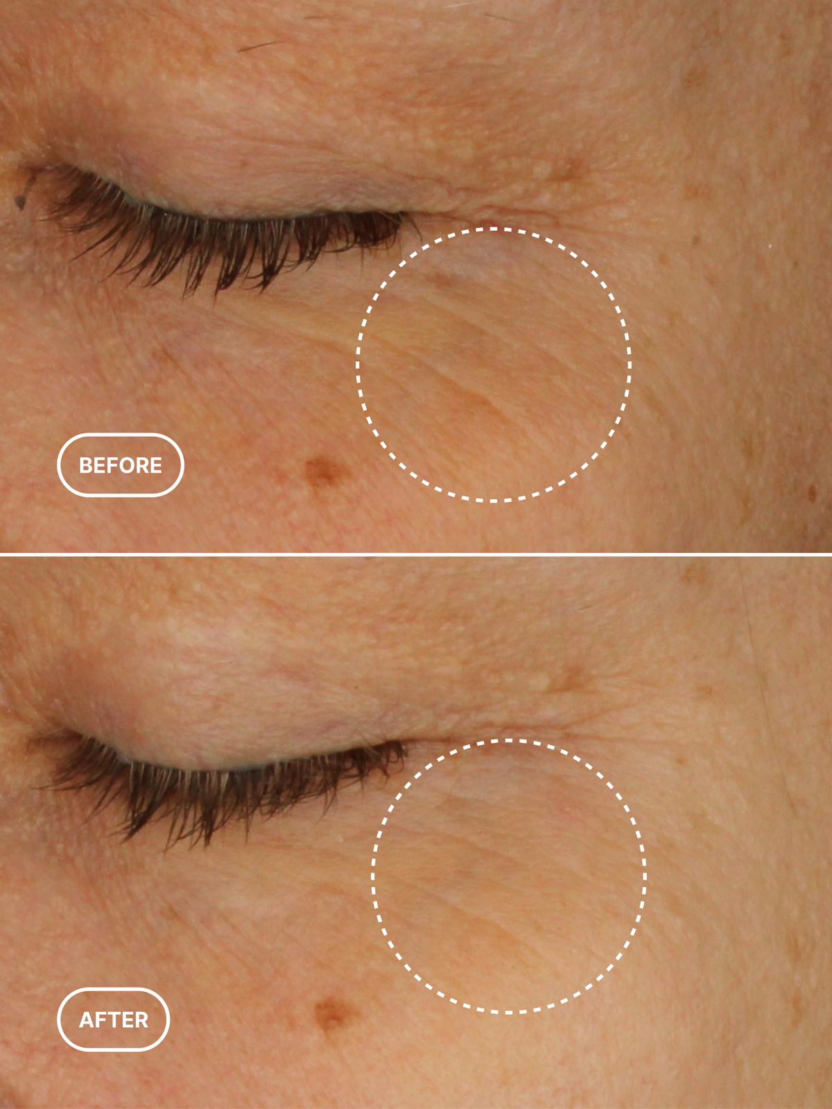 Retinol Alternative Eye Cream