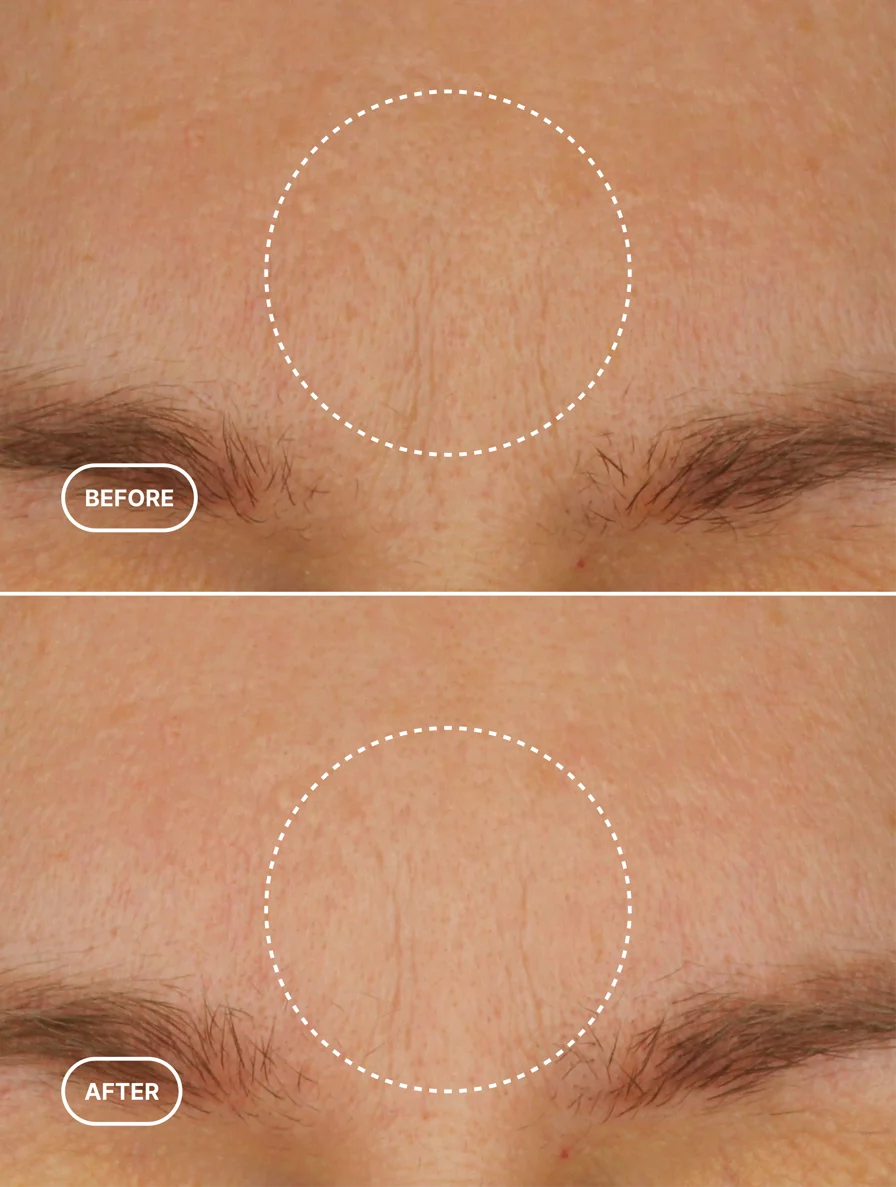 Bio-Retinol Moisturiser
