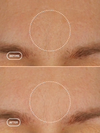 Bio-Retinol Moisturiser